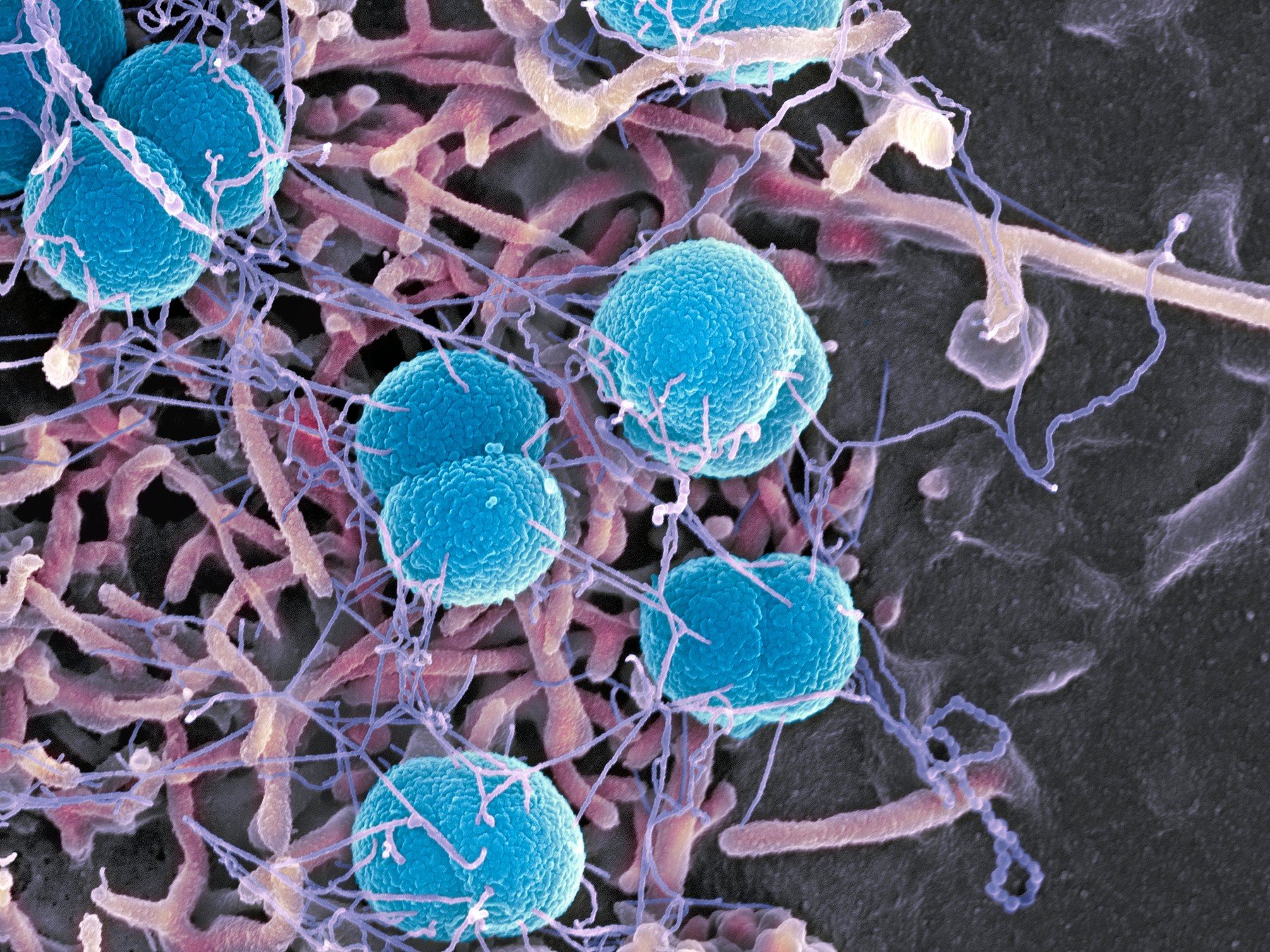 Obarvené bakterie meningokoka snímané elektronovým mikroskopem