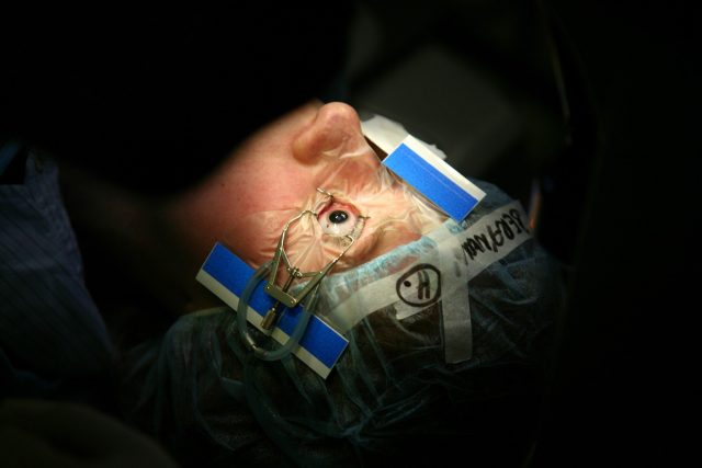 Operace očí  (ilustrační foto) | foto: Petra Mášová,  Empresa Media / Profimedia
