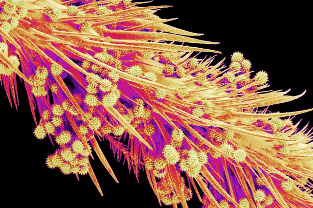 Pylová zrna zachycená elektronovým mikroskopem na noze včely medonosné | foto: Profimedia