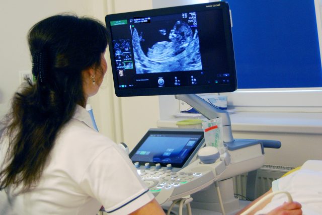 Ultrazvukové vyšetření na porodnicko-gynekologické klinice v Pardubicích | foto: Pardubická nemocnice